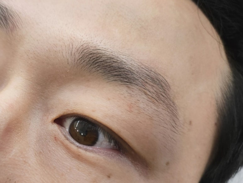 루즈에스테틱 이미지