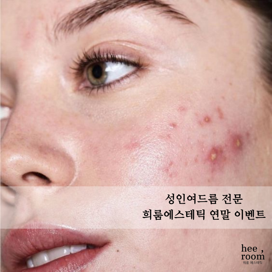 희룸 이미지