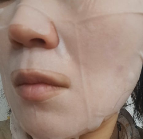 알로에피부연구소 이미지