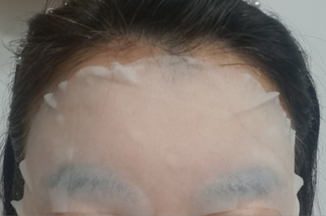 알로에피부연구소 이미지