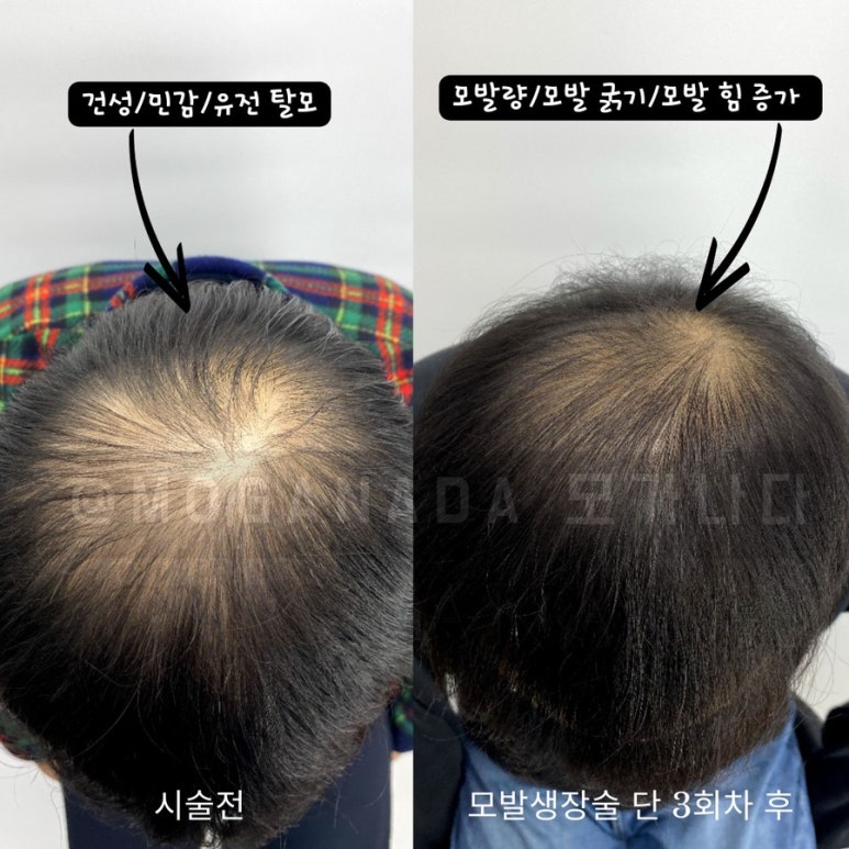 블래스유 이미지