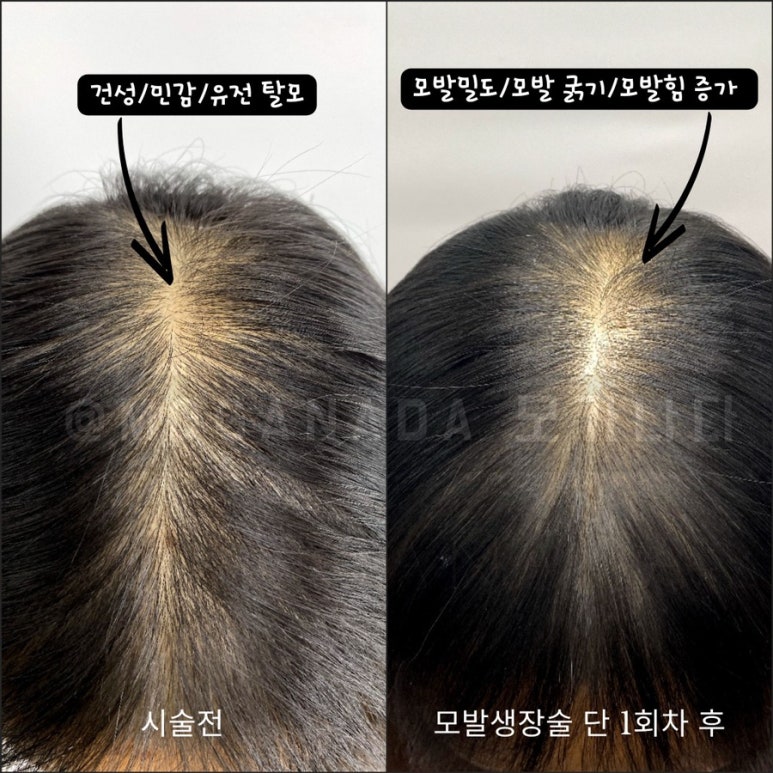 블래스유 이미지