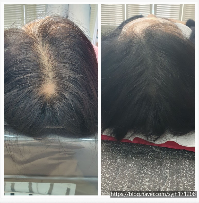 눈썹더하기 이미지
