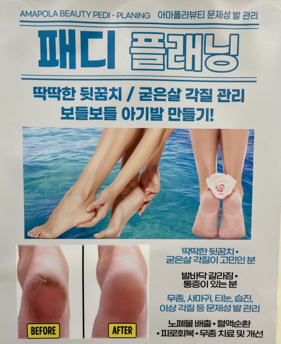 아마폴라뷰티 이미지
