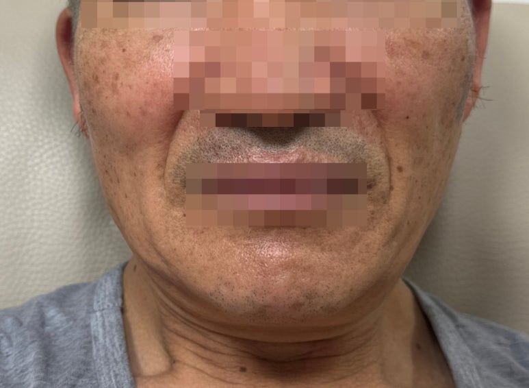 뷰티라운지강서 이미지