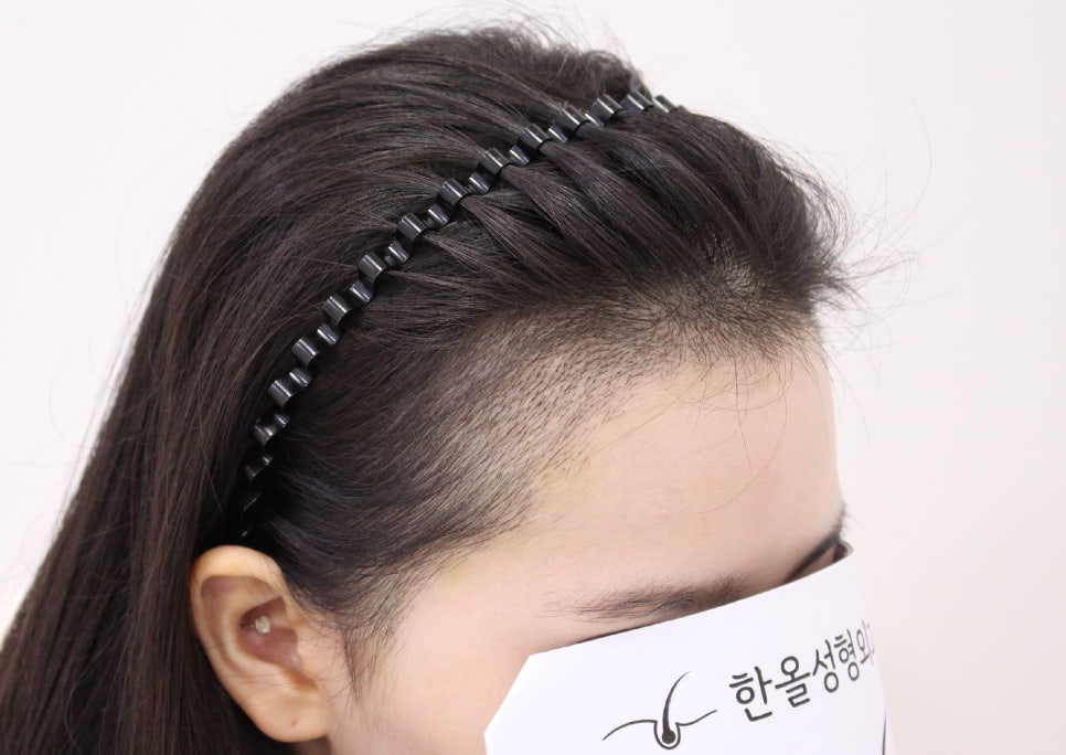 더헤어라인성형외과의원 이미지