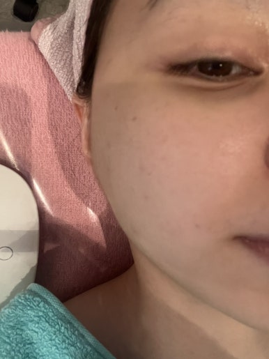 수소피부건강샵 이미지