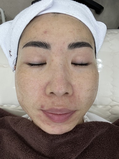 오투(O2)산소테라피 이미지