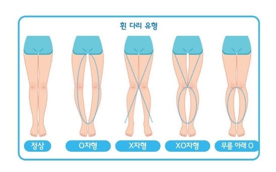 에이티라인 이미지