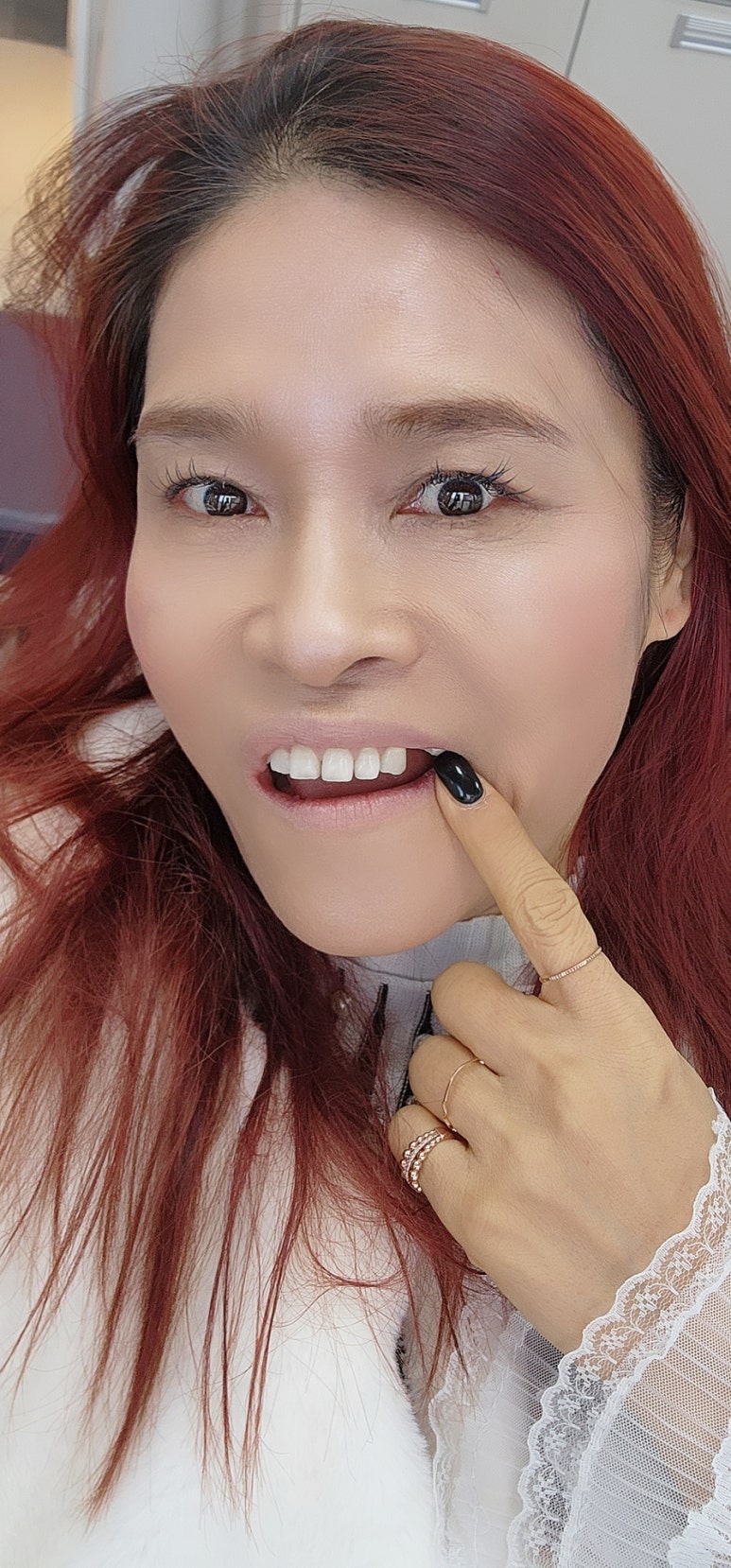 울들치과의원 이미지