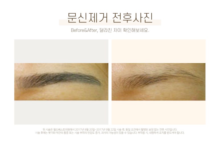 착한피부과 이미지