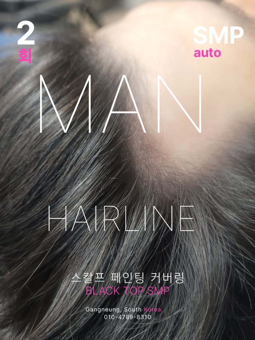 탑커버링 이미지