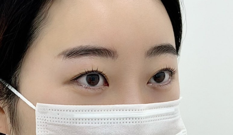 오뷰제 이미지