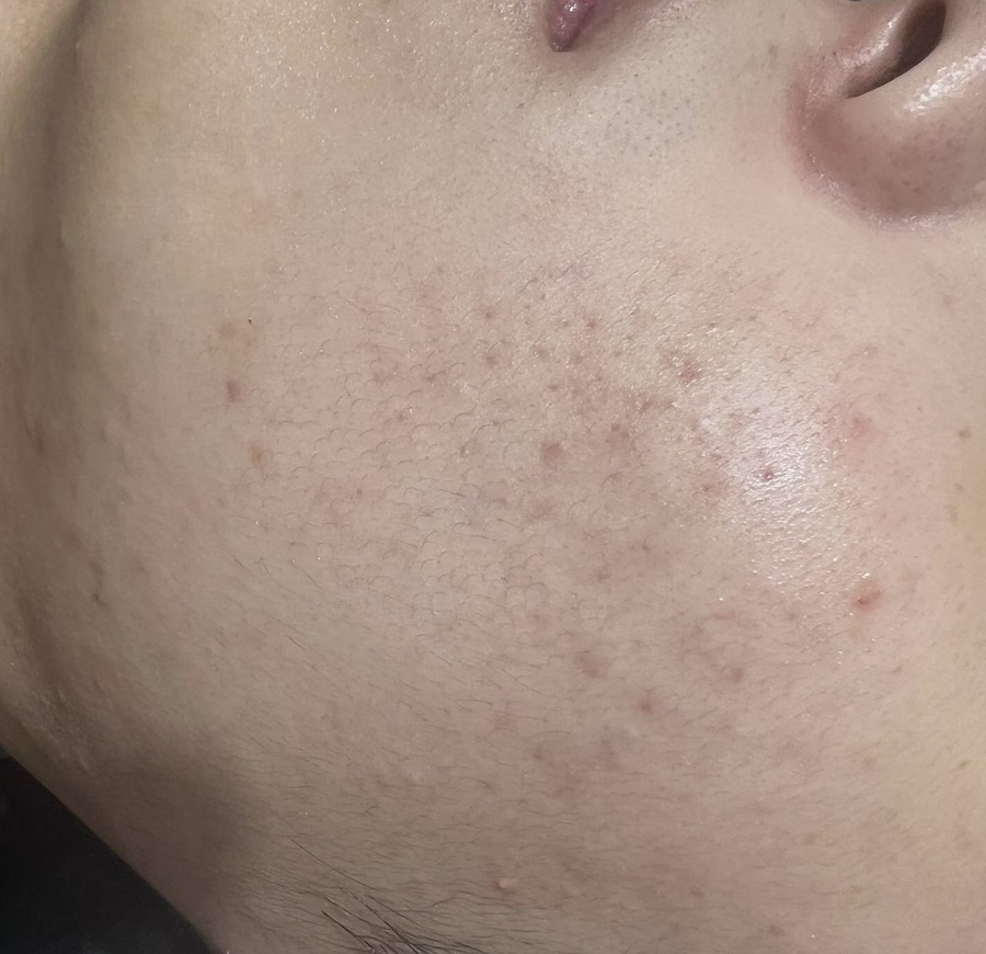 하얀피부관리샵 이미지