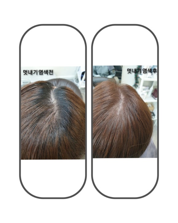 두피·탈모태후사랑하남점 이미지