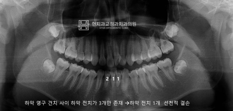 현치과교정과치과의원 이미지