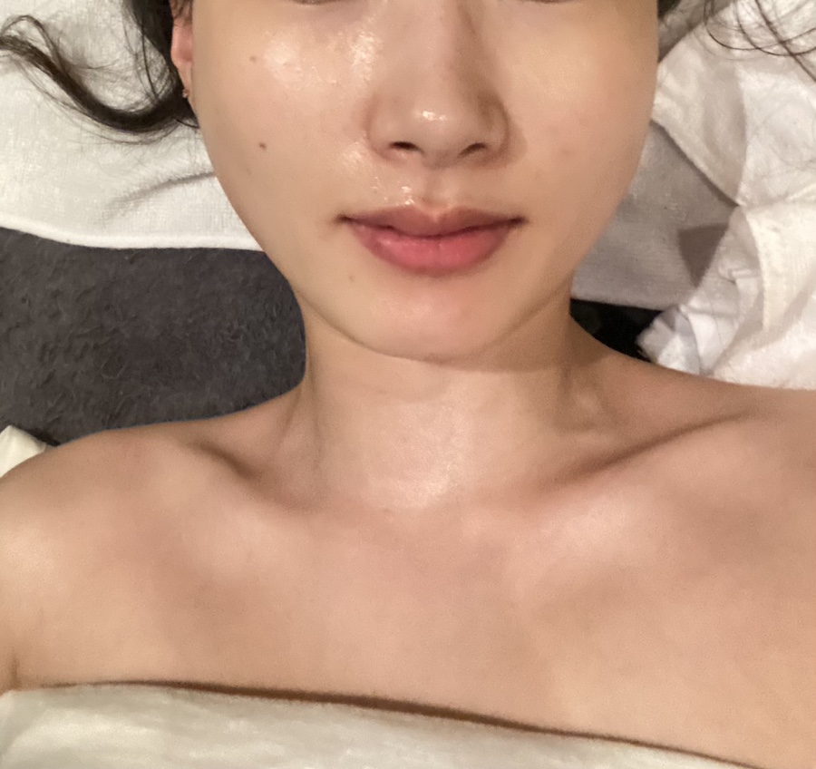 작은얼굴에스테틱 이미지