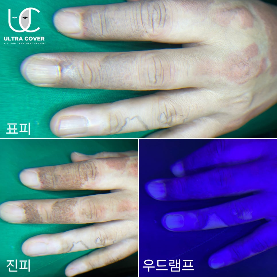 52아레테 이미지
