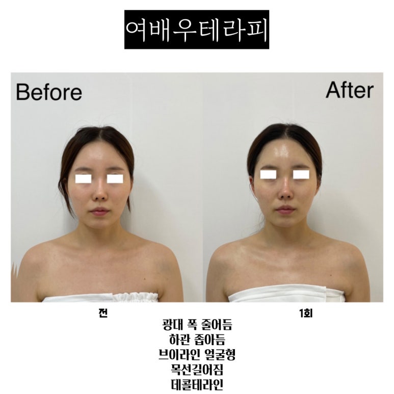 프엔느에스테틱 이미지