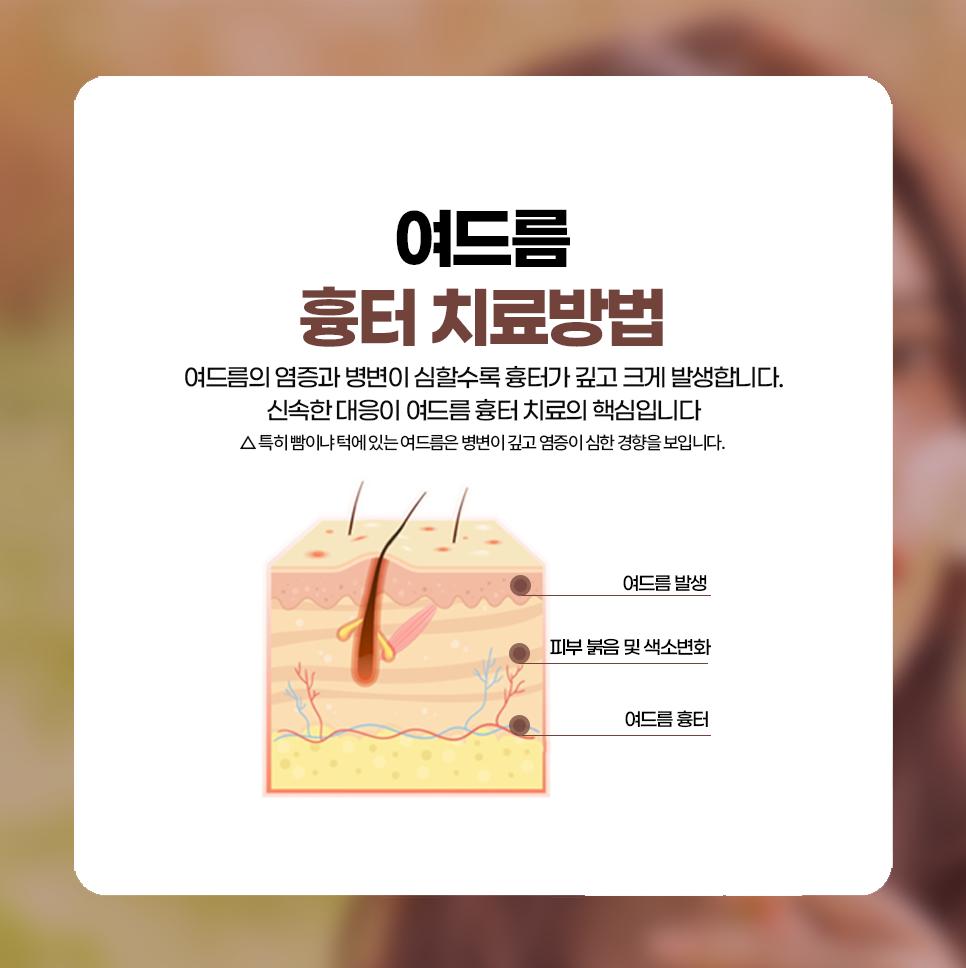 재상솔루션 이미지