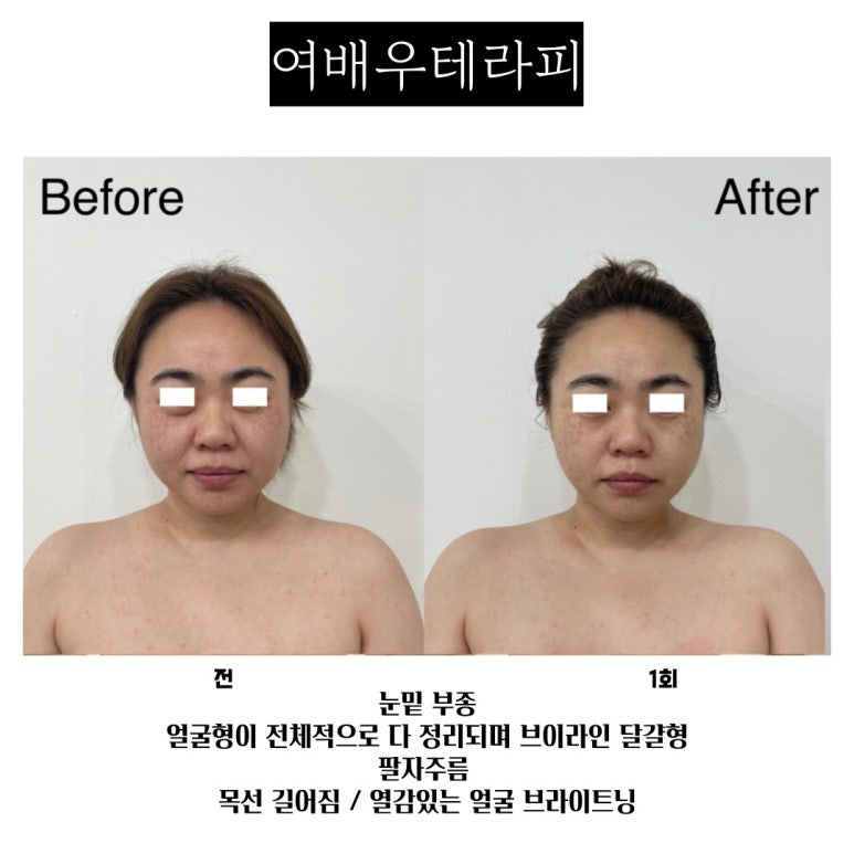프엔느에스테틱 이미지
