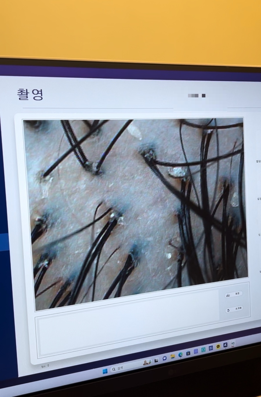 하루두피 분당정자점 이미지