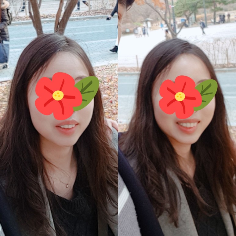 서울윌치과의원 이미지