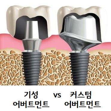 미소가득치과 이미지
