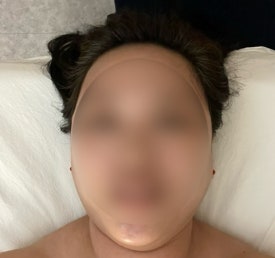 비주안에스테틱 이미지