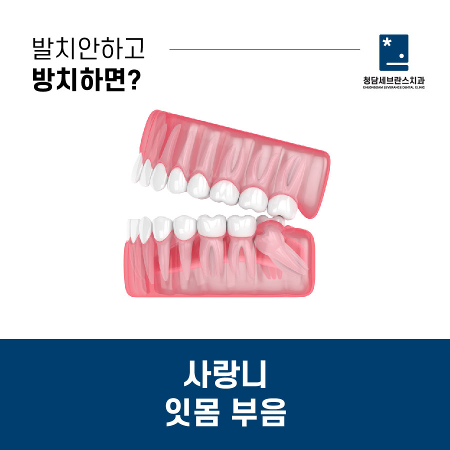 청담세브란스치과의원 이미지