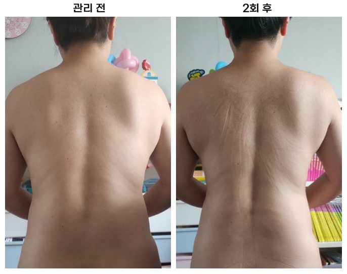 강북출장마사지 이미지