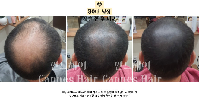 깐느헤어 이미지