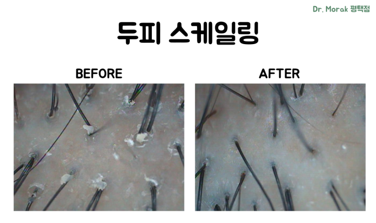 닥터모락 평택점 이미지