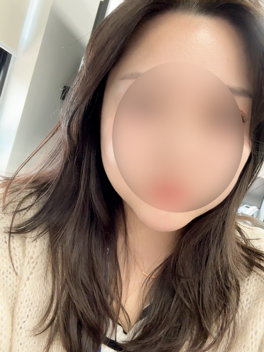 보나트페이스 이미지