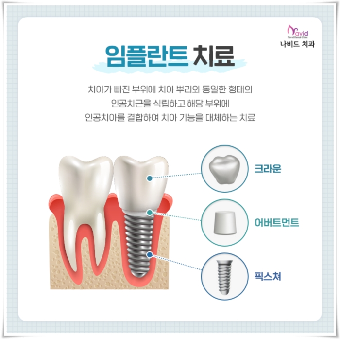 빛날빈치과 이미지