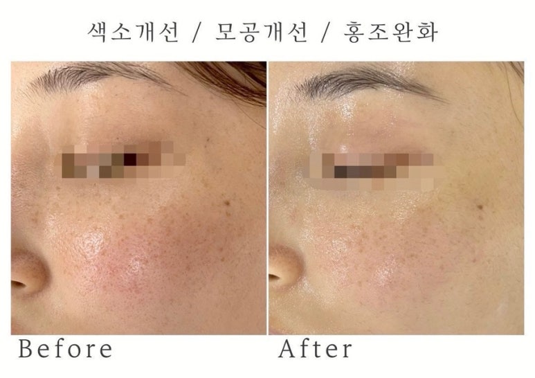 이엔뷰티 이미지