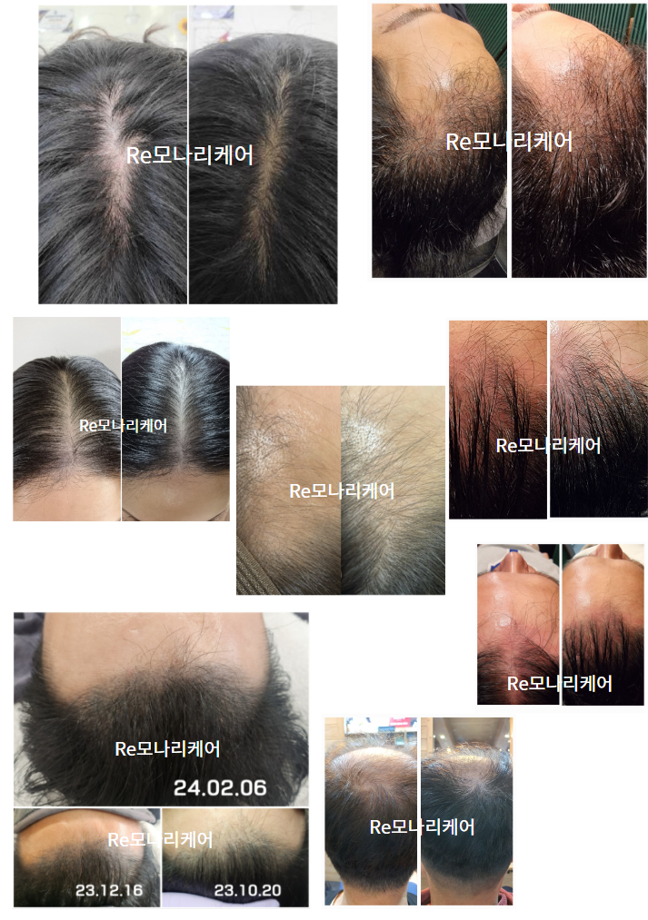 수아랑 스킨케어 이미지