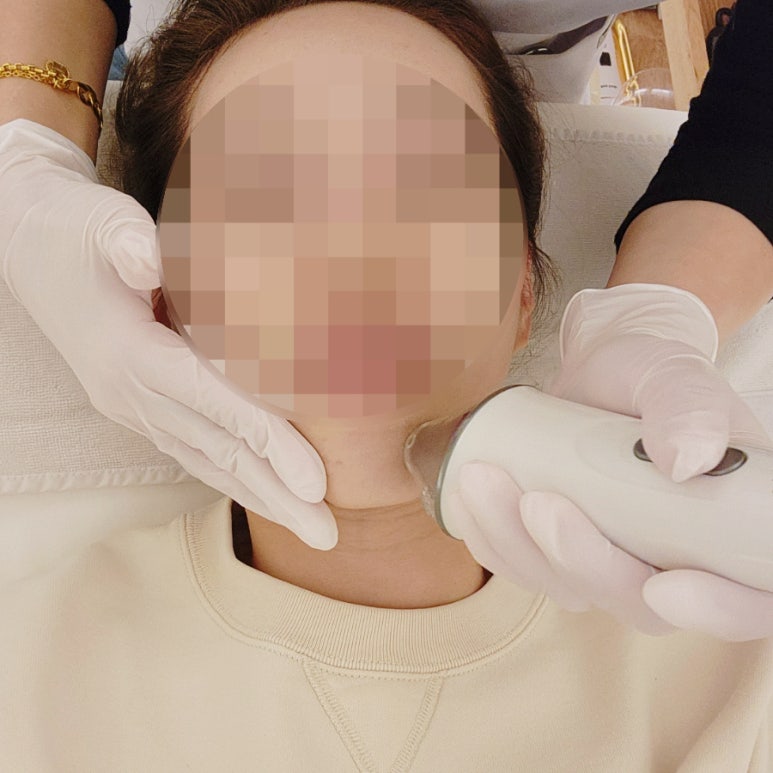 루시아 피부관리 이미지