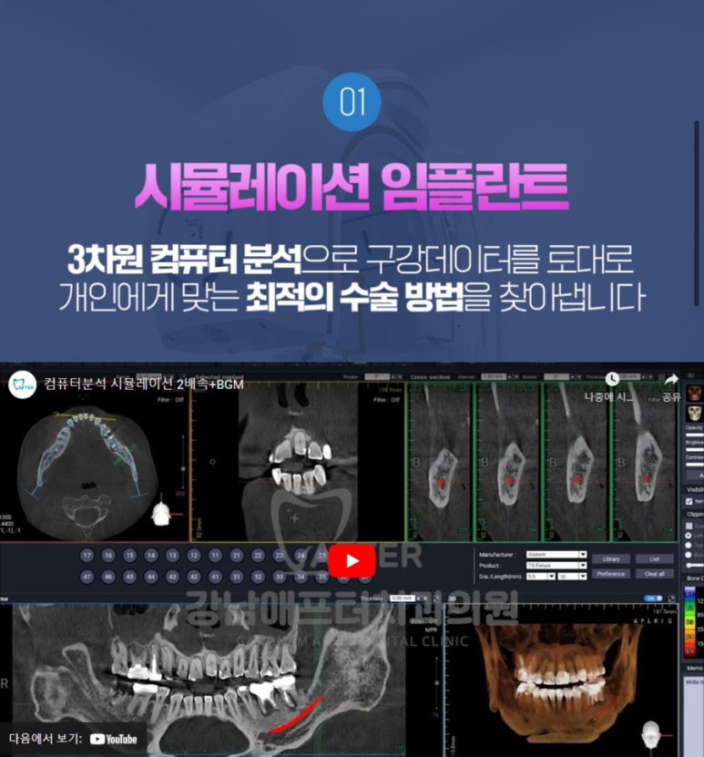 강남애프터치과 이미지