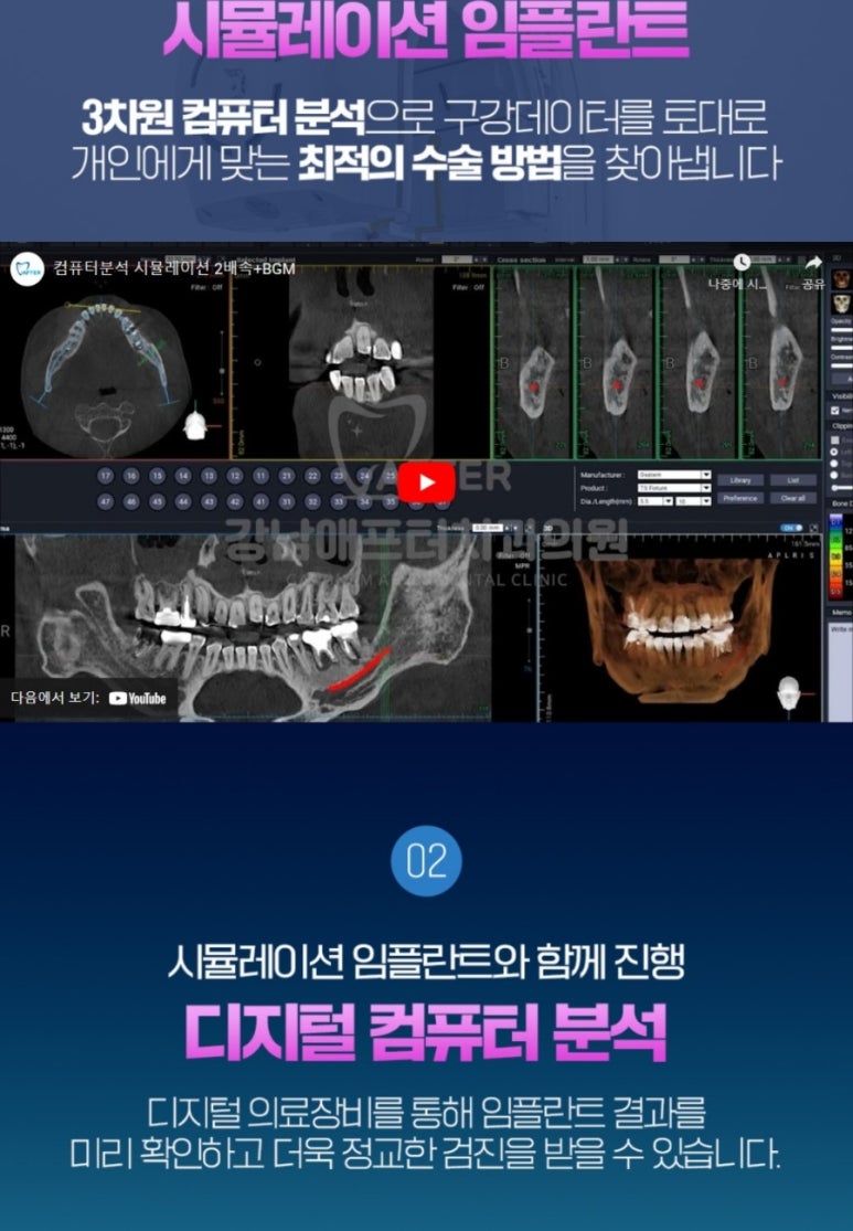 강남애프터치과 이미지