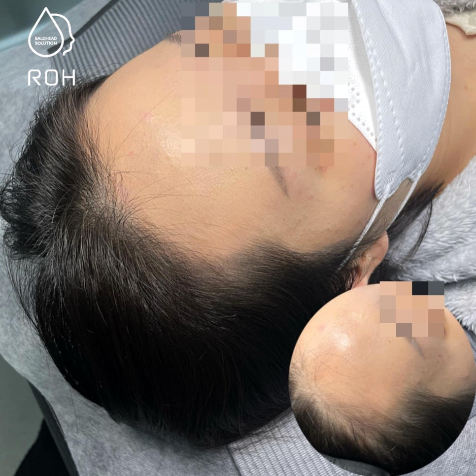 프로스칼프부산 이미지
