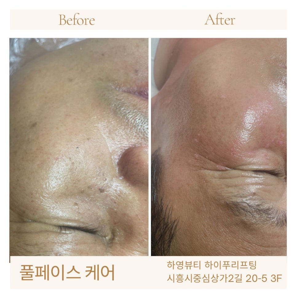하영피부관리 이미지