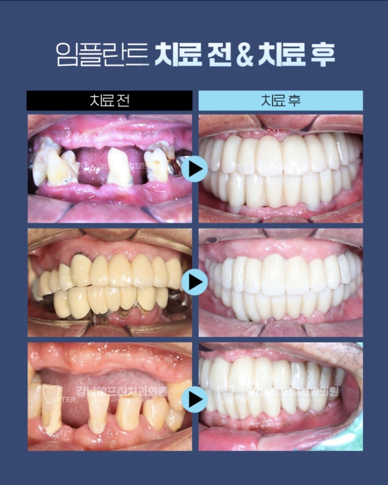 강남애프터치과 이미지