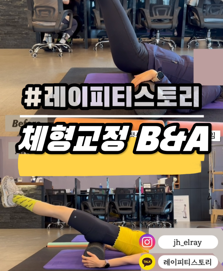 피티스토리 이미지