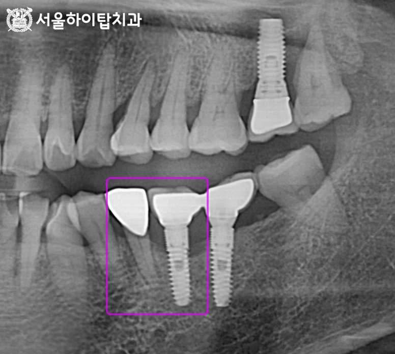 하이서울치과의원 이미지