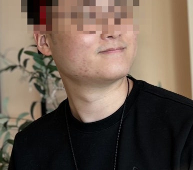 위레브에스테틱 이미지
