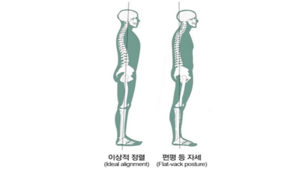 플랫우리 이미지