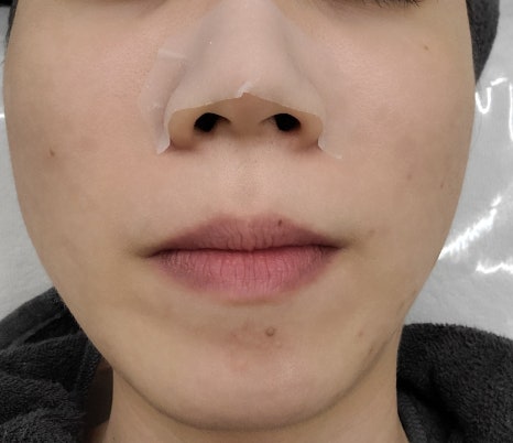 루즈에스테틱 이미지