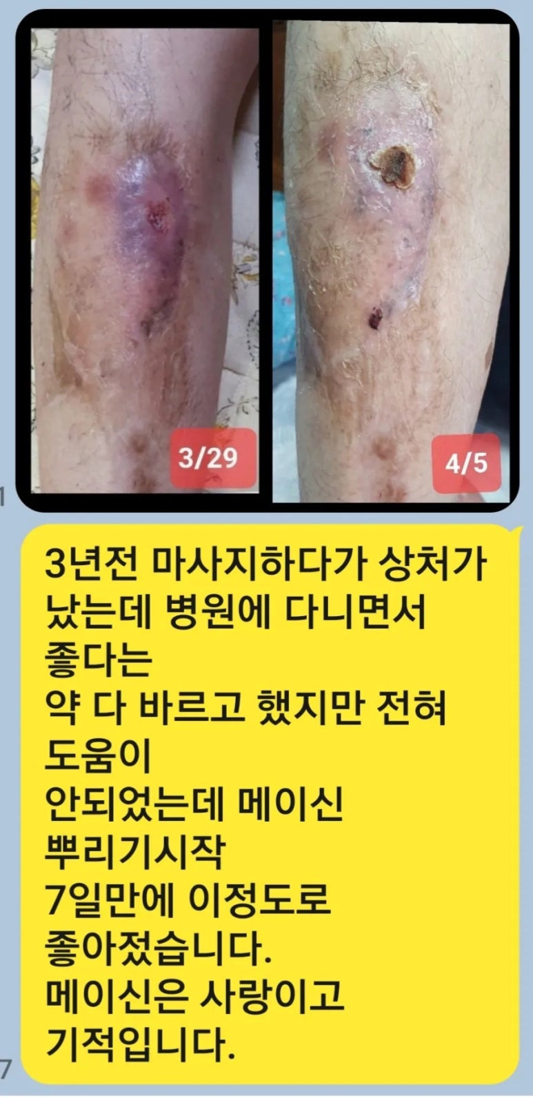 통증없는세상만들기 이미지
