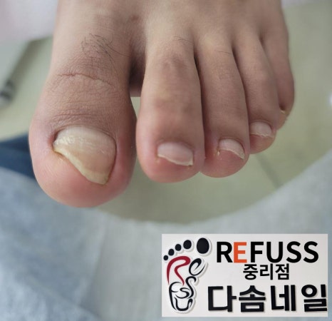 대전레푸스다솜네일 이미지